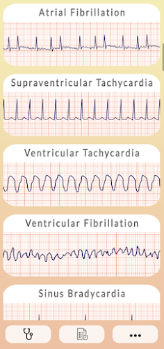 ECG Guide  Screenshot 3