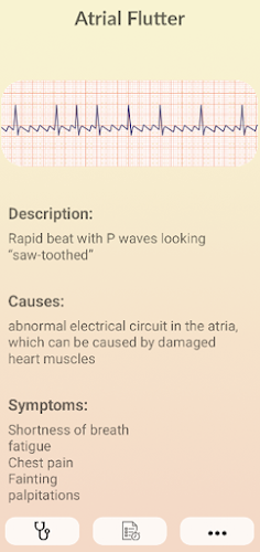 ECG Guide  Screenshot 2