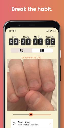 NailKeeper - Stop Biting Nails  Screenshot 2