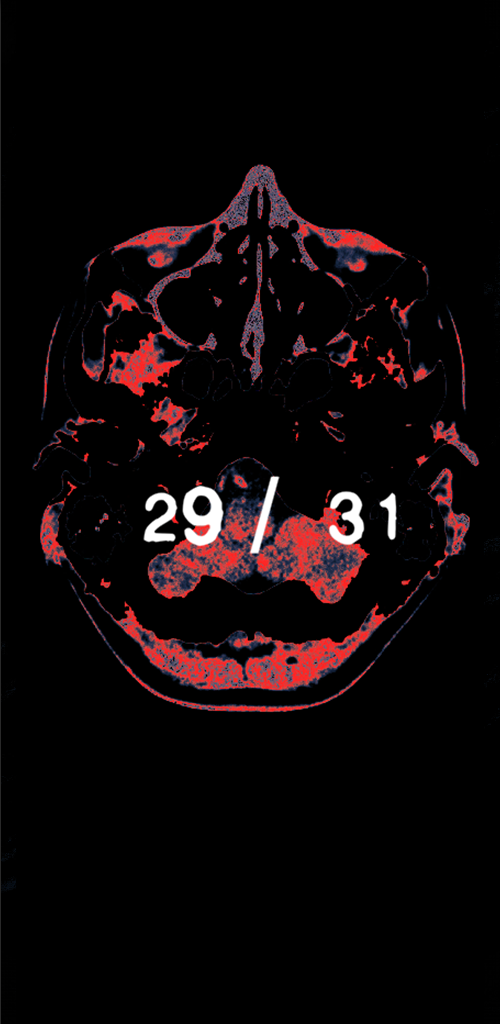 BITE  Screenshot 1
